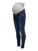 ONLY MATERNITY Zwangerschapsjeans OLMWAUW MID SK DNM BJ5 NOOS